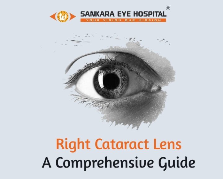 Right Cataract Lens: A Comprehensive Guide