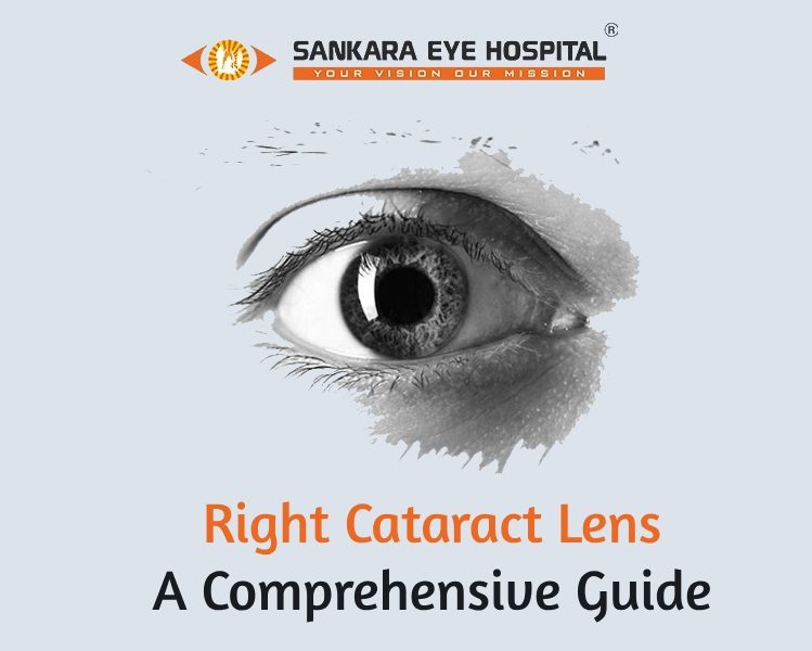 Which lens is best for cataract surgery Sankara